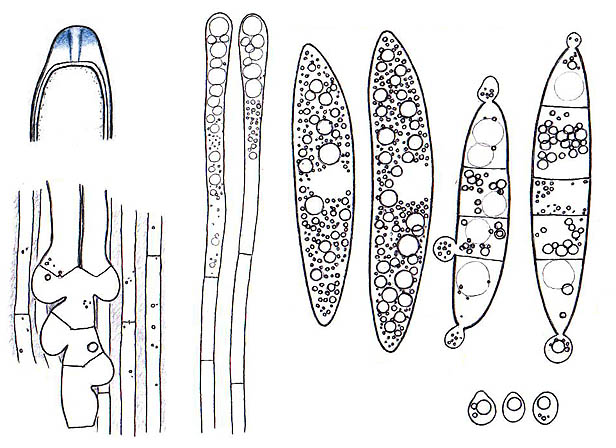 Ascocoryne